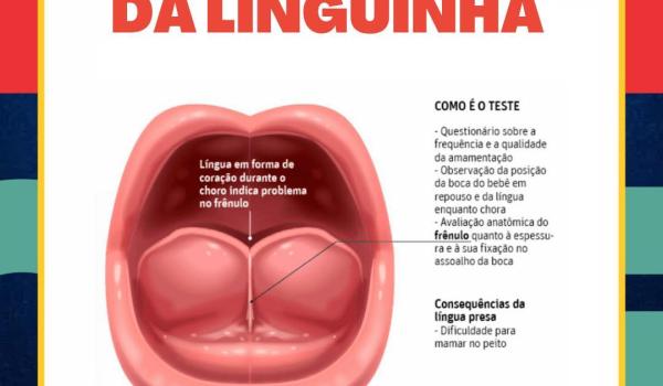 Imagens da Teste da Orelhinha e Teste da Linguinha